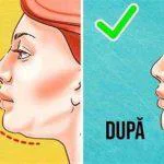 Cum sa scapi de gusa: Ghid complet